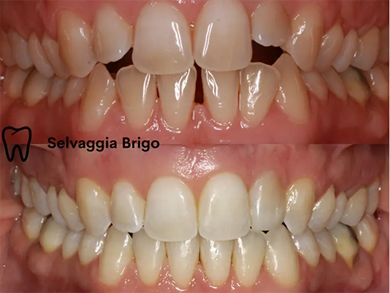 Brigo Selvaggia Dentista